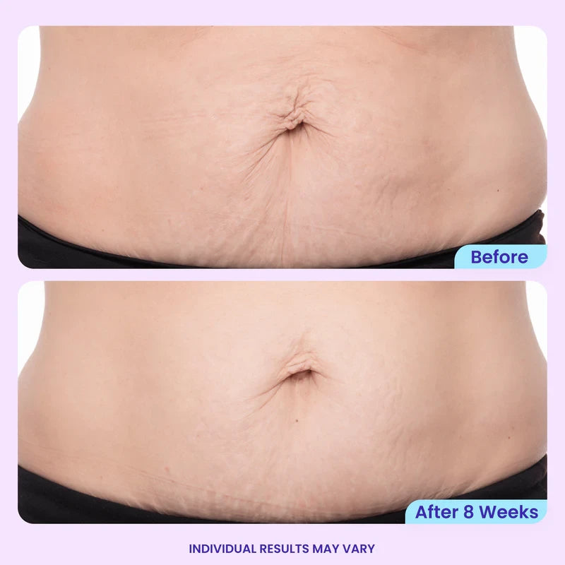 Belly Tightening Cream